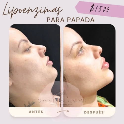 Imagen de servicio